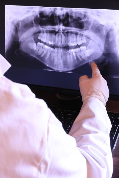 Best Emergency Dental Extractions in Frederickson, WA
