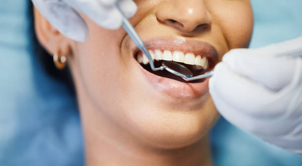Best Emergency Dentist for Special Needs Patients in Frederickson, WA